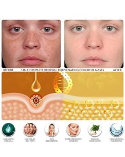 5-in-1 Renewal Multi-Treatment Masks 16pc Set Women -Beauty Product Store 1111146068 RLLD 5