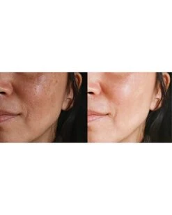 Skin Rejuvenation Device Women -Beauty Product Store 1111939339 RLLD 2