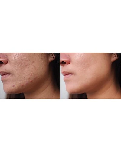 12x PRO LED Device With Spa Steam Hot/Cold Technologies Women 5 12x PRO LED Device With Spa Steam Hot/Cold Technologies Women - Image 3